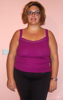 Alessi Debora dopo la dieta Bioimis