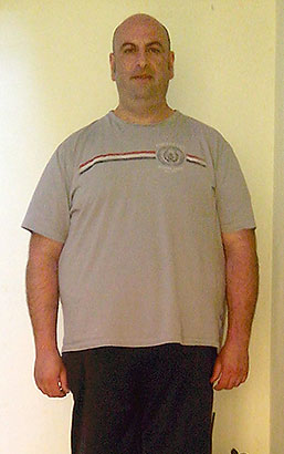 Francesco Cristofaro prima della dieta Bioimis