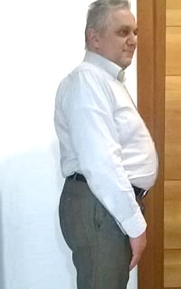 Carlo Aldegheri prima della dieta Bioimis