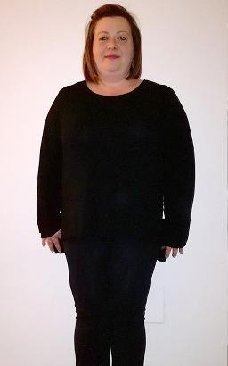 Palmina Miccolis prima della dieta Bioimis