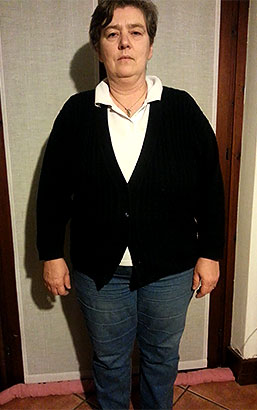Roberta Brentegani prima della dieta Bioimis