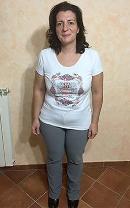 Antonella Maddalena prima della dieta Bioimis