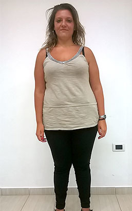Federica Calò prima della dieta Bioimis