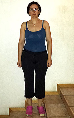 Elena Becquet prima della dieta Bioimis