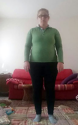 Francesca Ortolan prima della dieta Bioimis