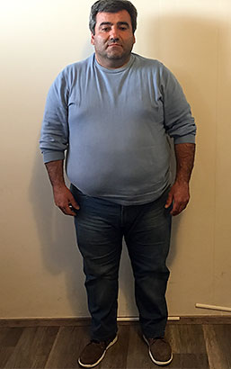 Rocco Spano' prima della dieta Bioimis