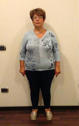 Maria Scavo prima della dieta Bioimis