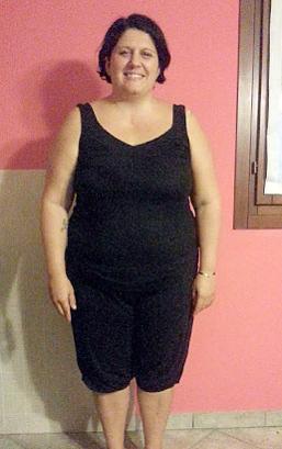 Irene Binato prima della dieta Bioimis