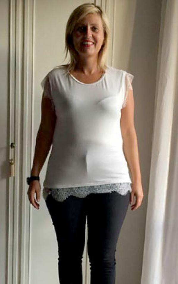 Maria De Stefano dopo la dieta Bioimis