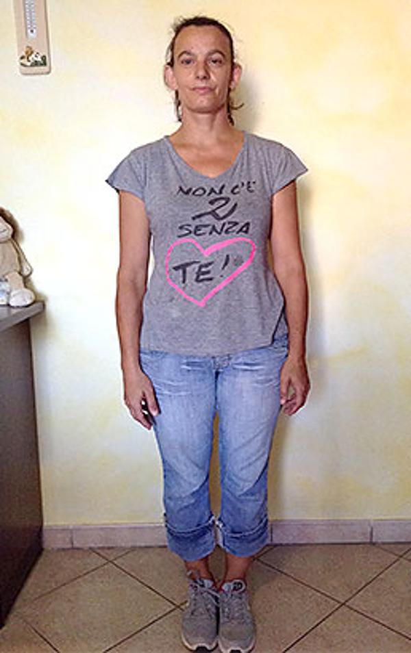 Francesca Castioni dopo la dieta Bioimis