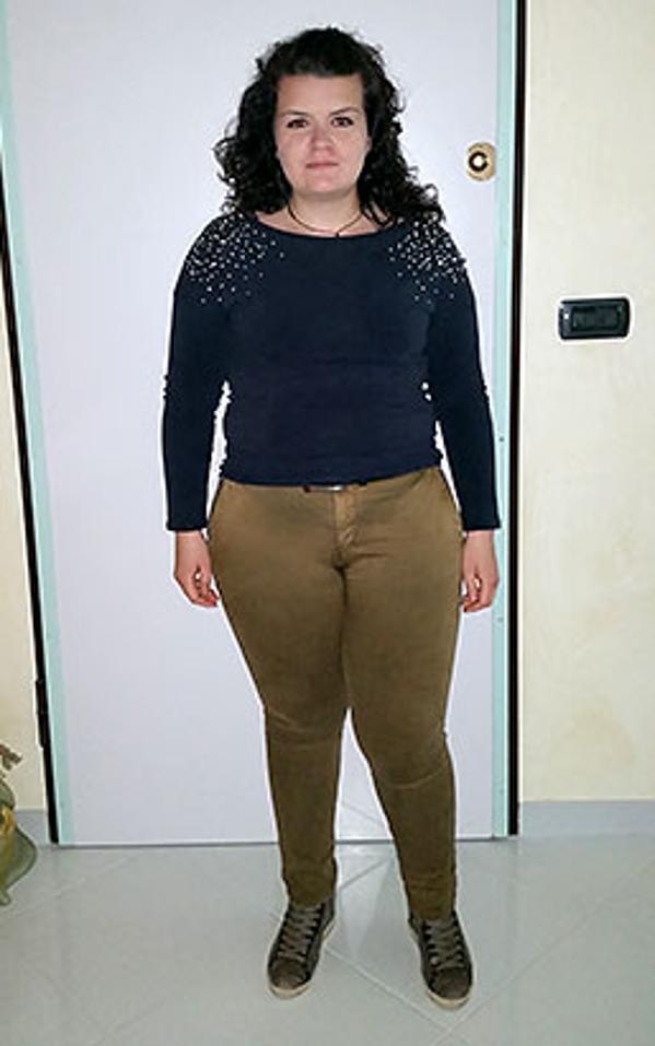 Cristina De Astis prima della dieta Bioimis