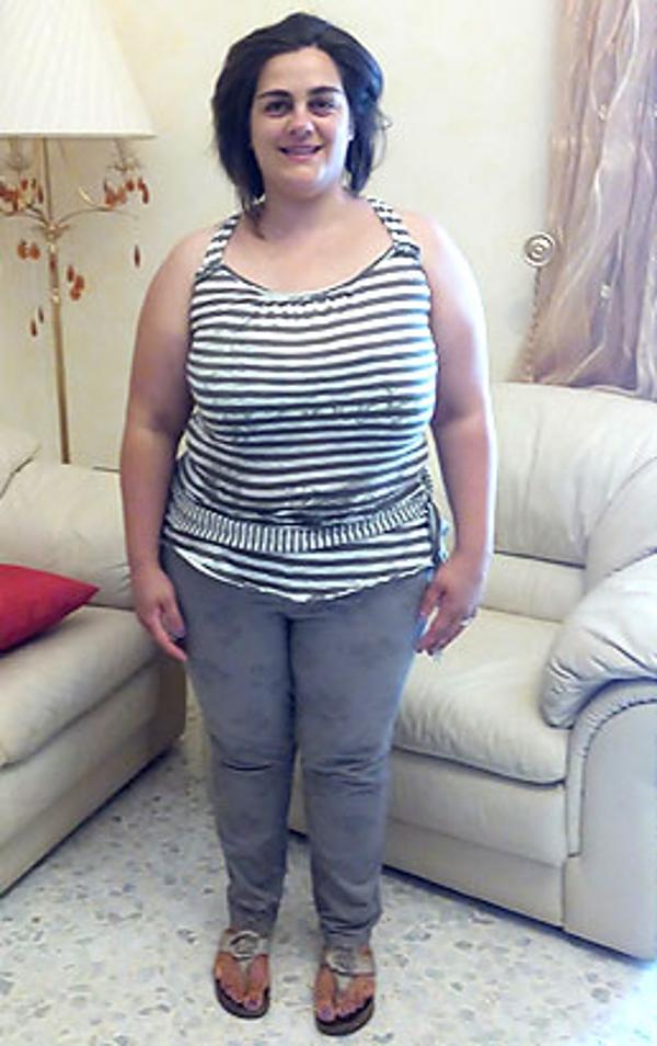 Angela Gangale prima della dieta Bioimis