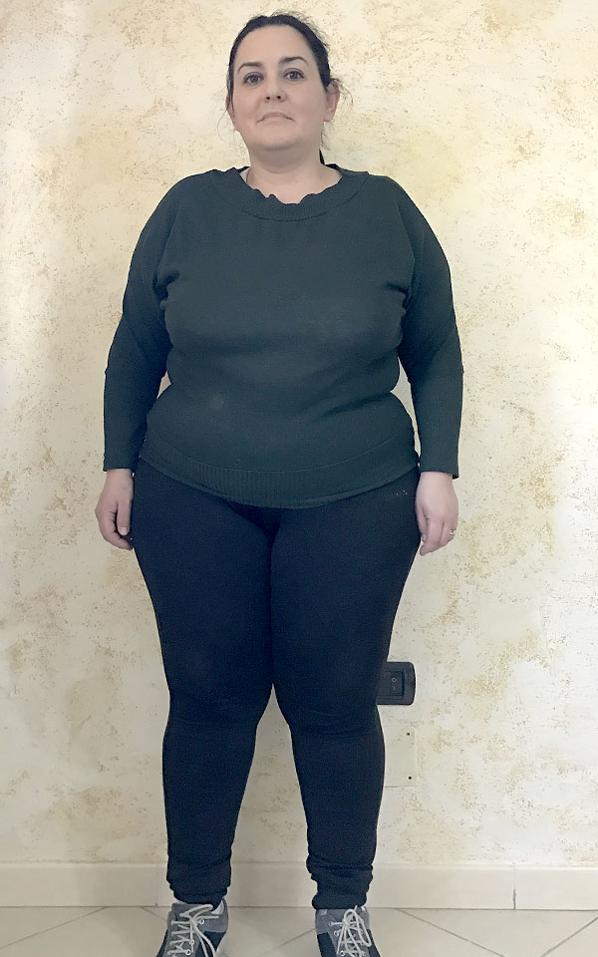 Francesca Cipolla prima della dieta Bioimis
