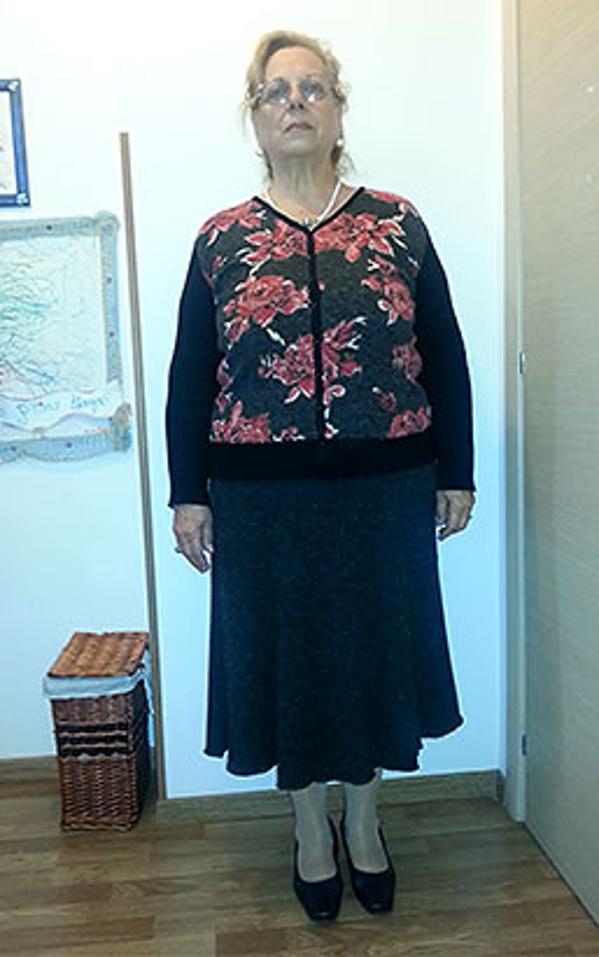 Maria Tarantino prima della dieta Bioimis