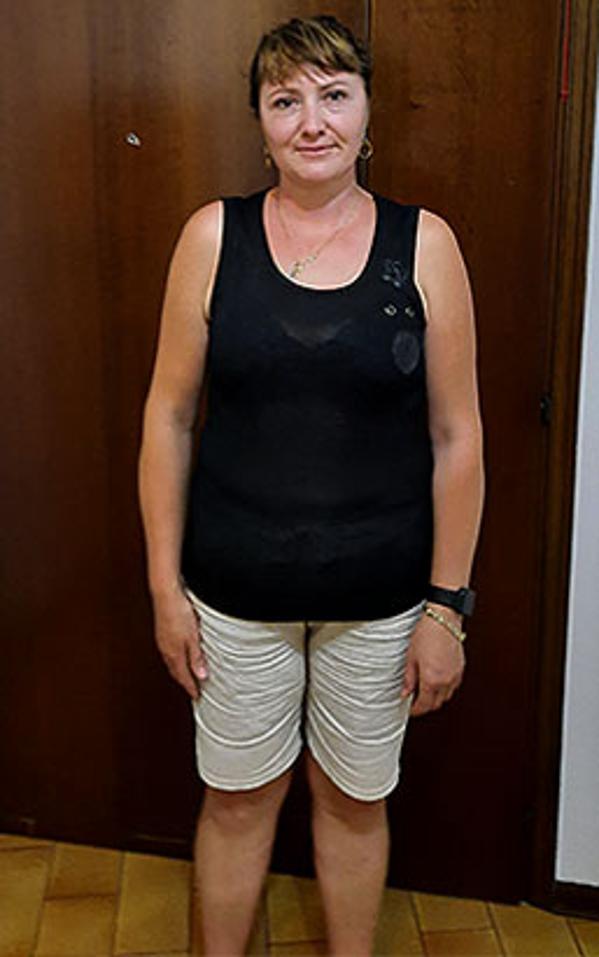 Alina Mamait dopo la dieta Bioimis
