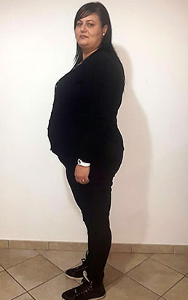 Fabiana Accoto prima della dieta Bioimis