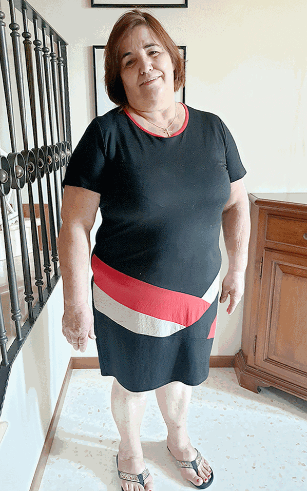 Lorenzina Dal Pra prima della dieta Bioimis