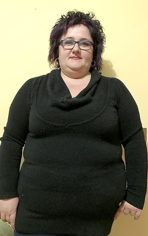 Liliana Macrito prima della dieta Bioimis