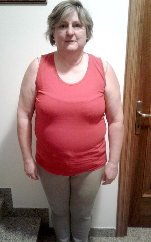 Emanuela Bittante prima della dieta Bioimis