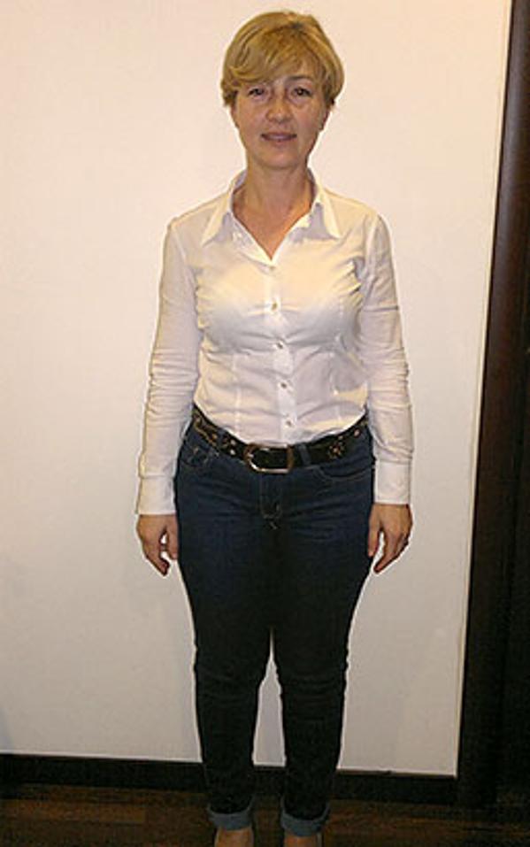 Nicoletta Lorusso prima della dieta Bioimis