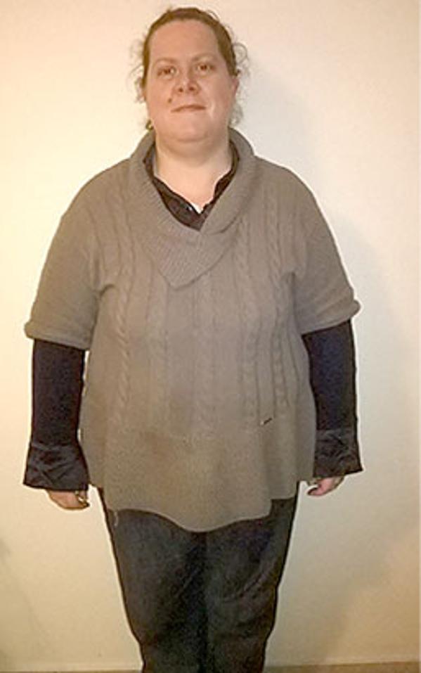 Maria Messina prima della dieta Bioimis
