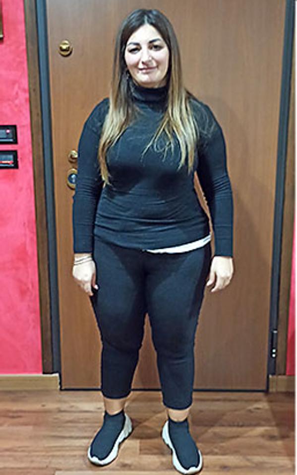 Marika Giangregorio prima della dieta Bioimis
