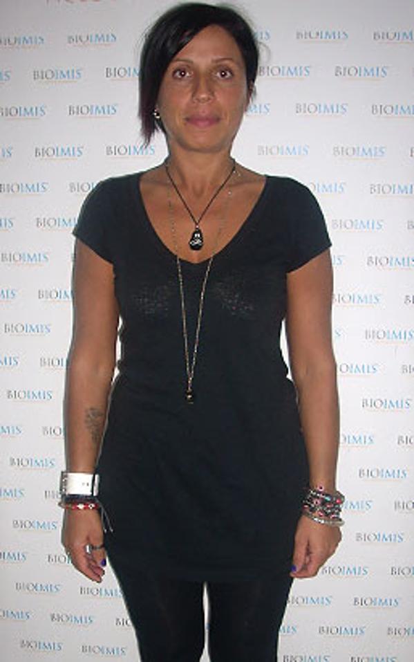 Curcio Angela prima della dieta Bioimis