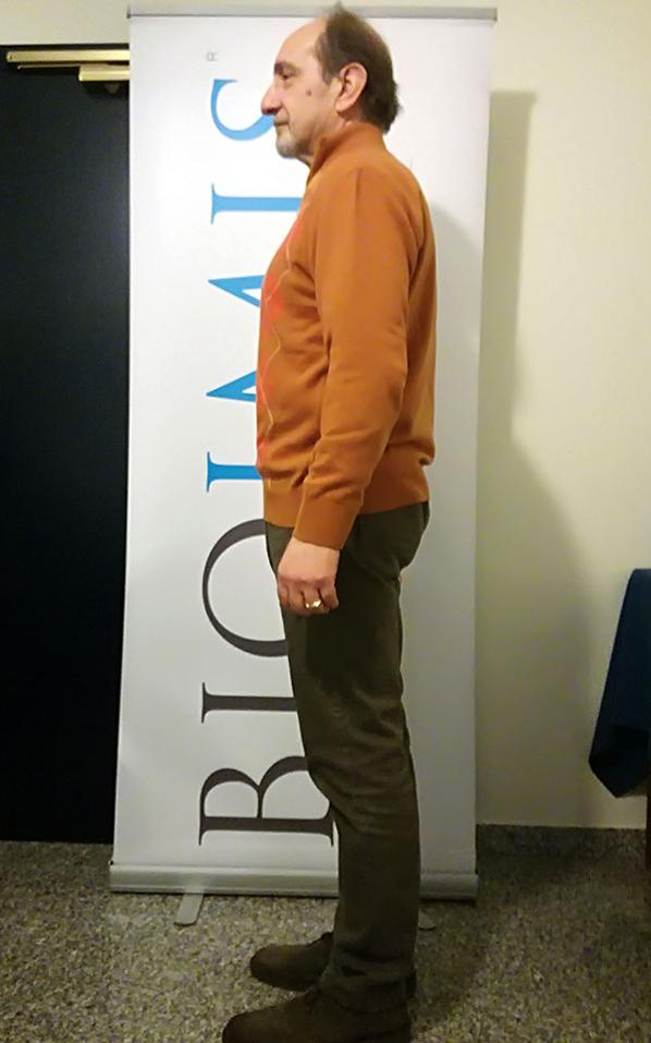 Antonio Pascazio dopo la dieta Bioimis