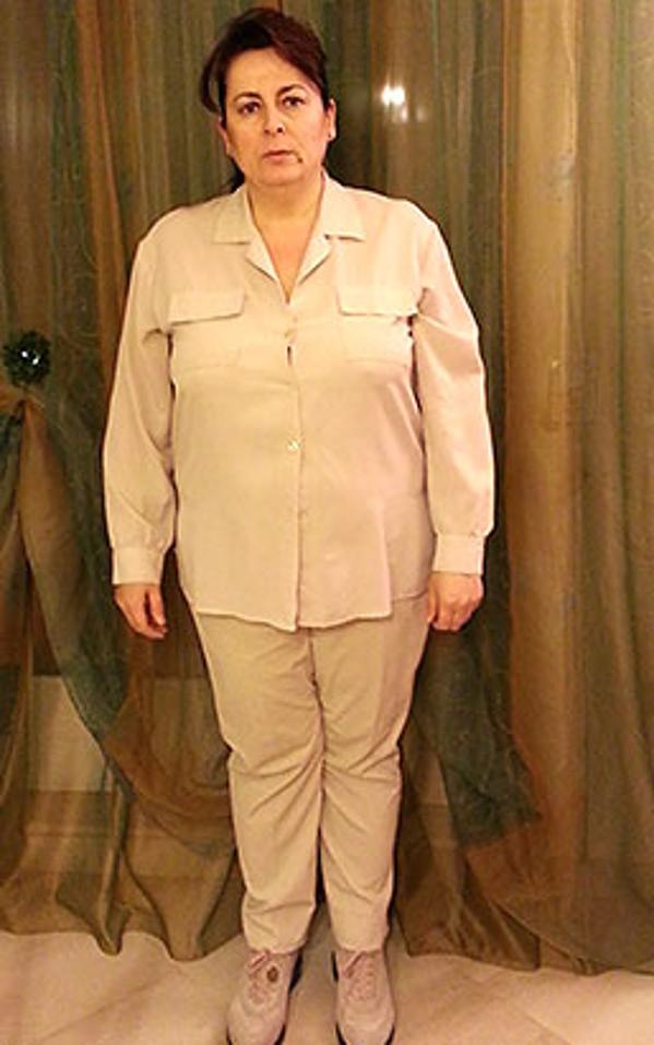 Margherita Franco prima della dieta Bioimis