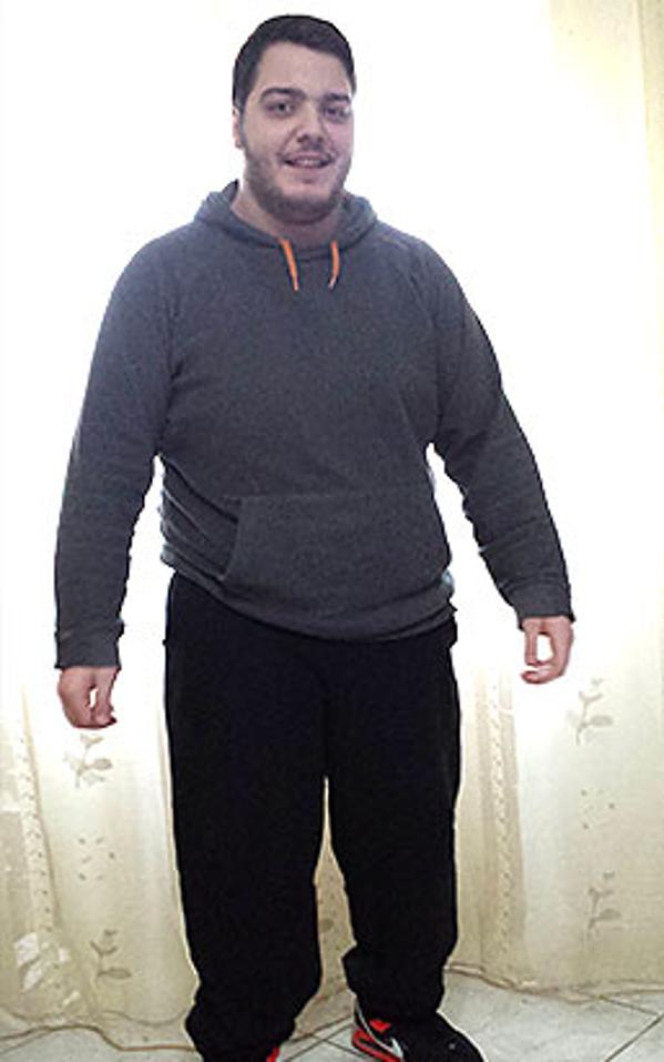 Giuseppe Oscuro prima della dieta Bioimis