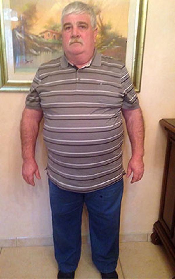 Salvatore Errico prima della dieta Bioimis