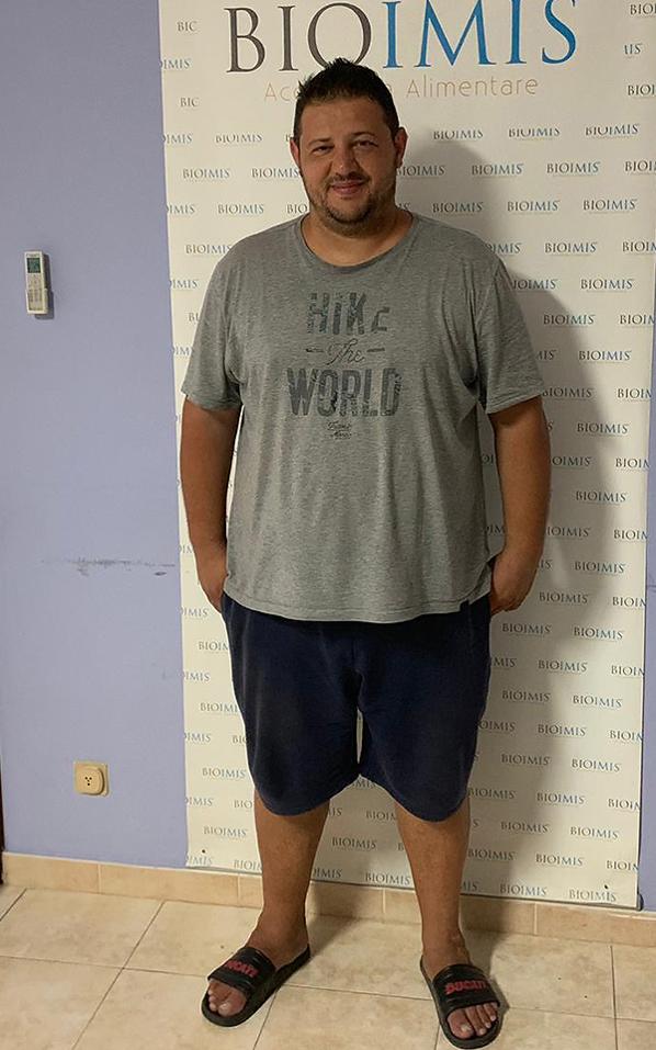 Angelo Orto prima della dieta Bioimis