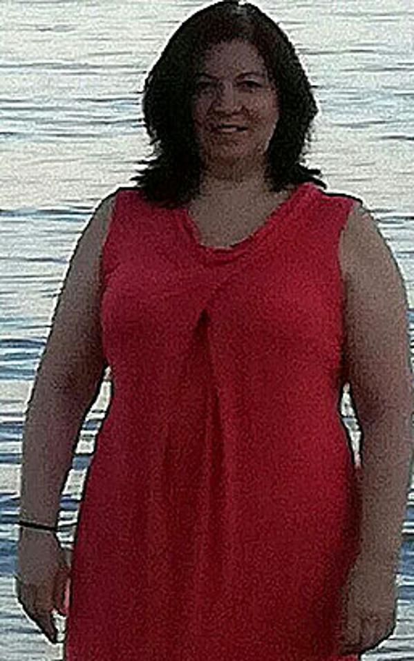 Linda Drago prima della dieta Bioimis