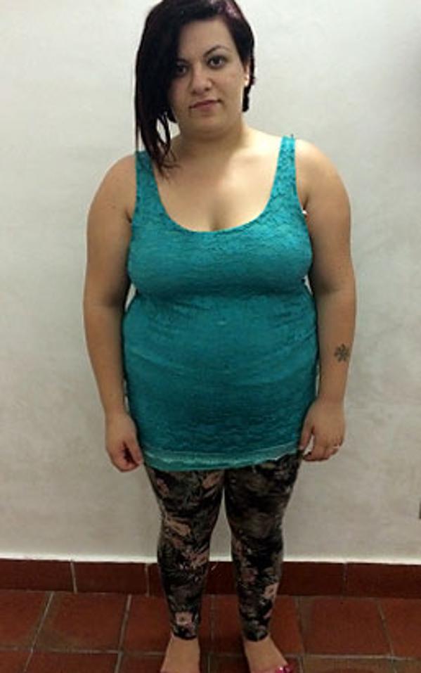 Marisa Ferruzzi prima della dieta Bioimis