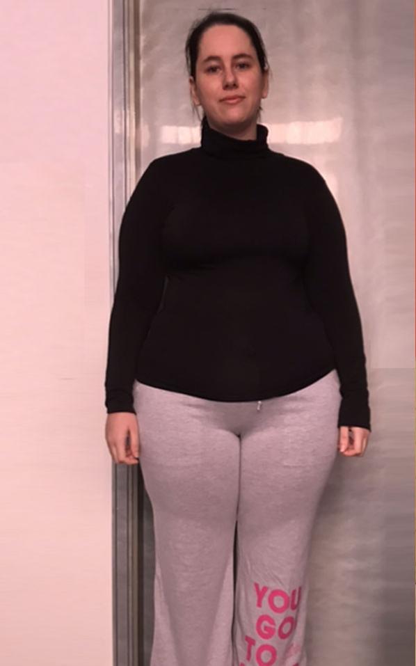 Cristina La Rosa prima della dieta Bioimis