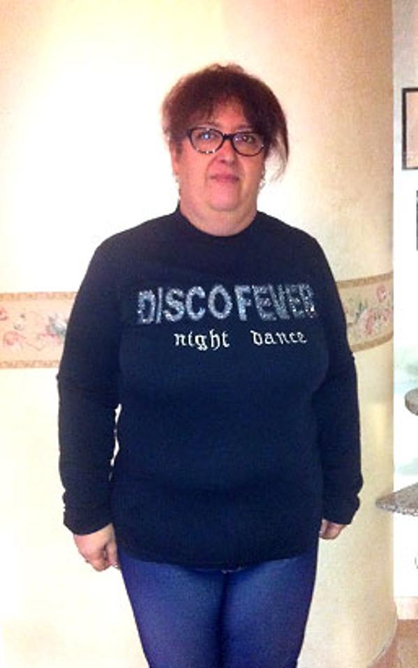 Ignazia Castorino prima della dieta Bioimis