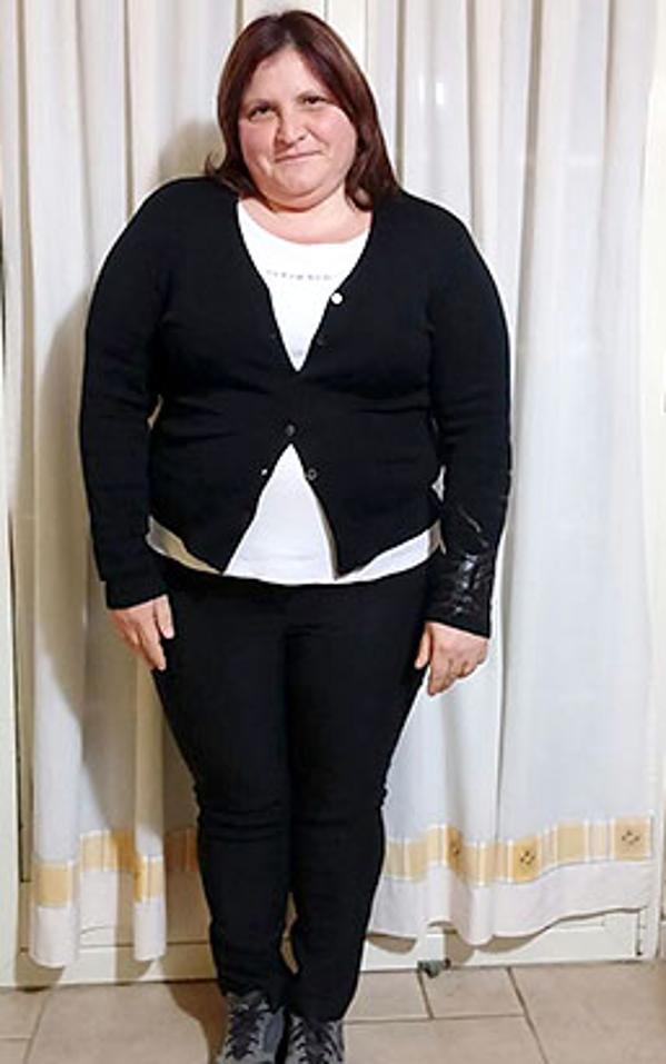 Maria Catena Rita Tizzone prima della dieta Bioimis