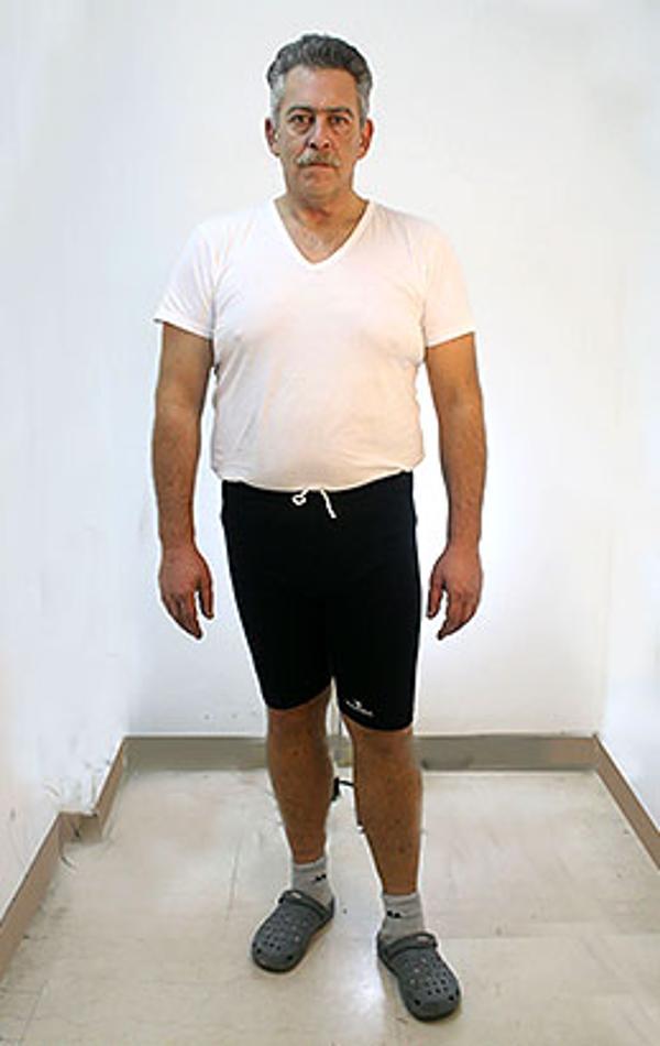 Andrea Pace dopo la dieta Bioimis