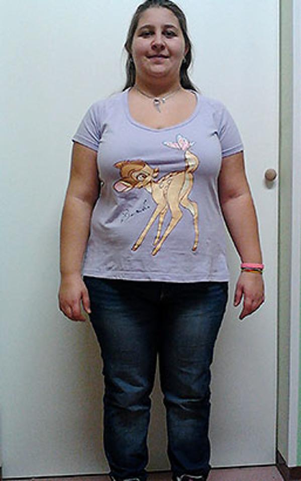 Daniela Cantini prima della dieta Bioimis