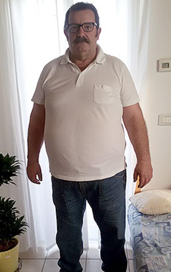 Gino Pettenuzzo prima della dieta Bioimis