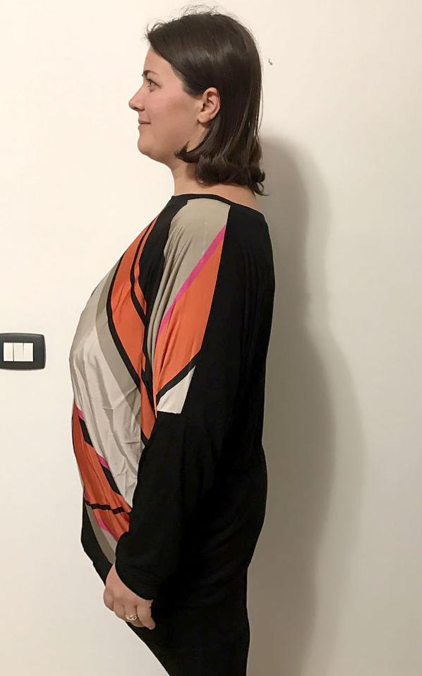 Lili Lonardo dopo la dieta Bioimis