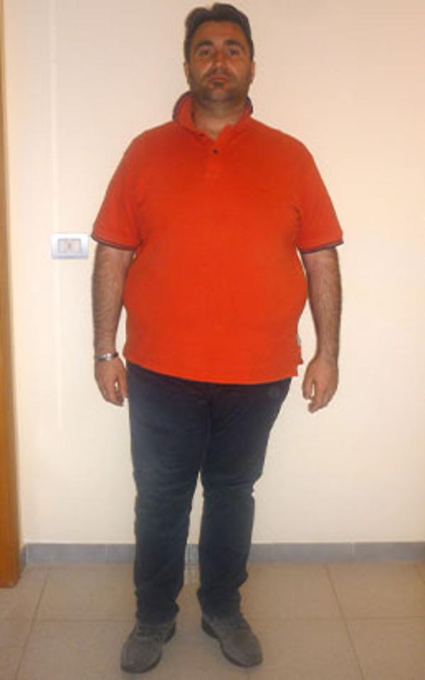 Michele Violillo prima della dieta Bioimis