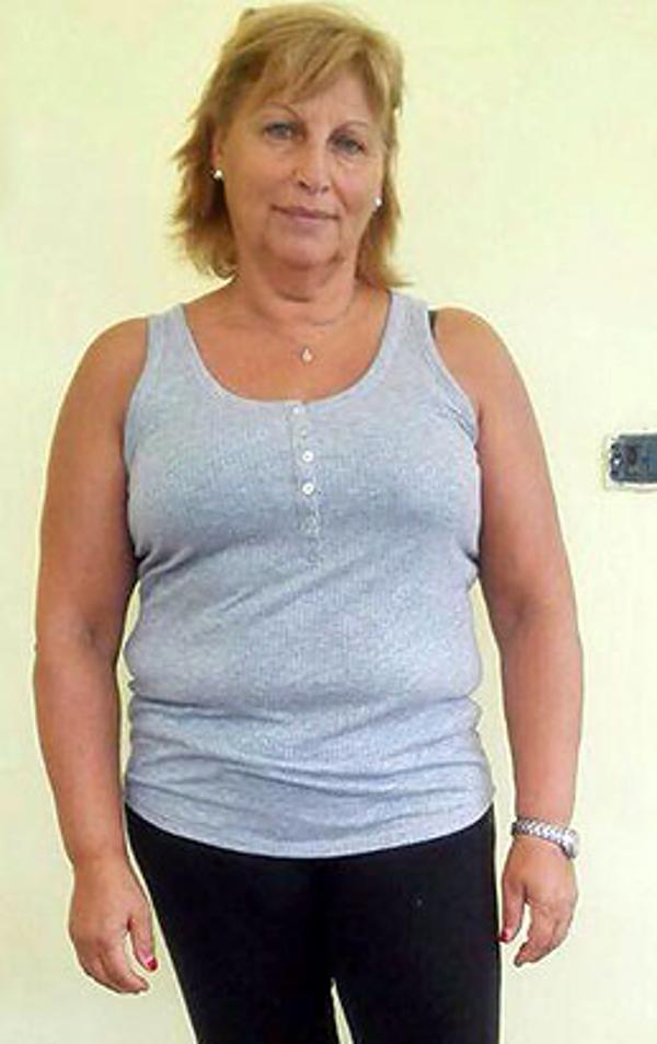 Anna Romanazzi prima della dieta Bioimis