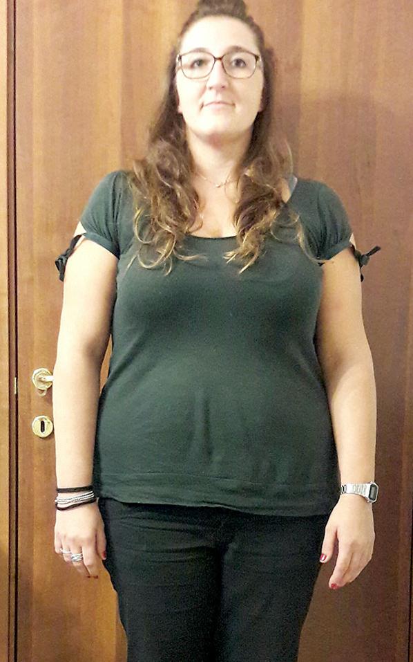 Cristina Morini prima della dieta Bioimis