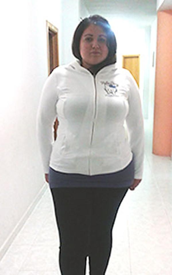 Giulia Giovinazzo prima della dieta Bioimis