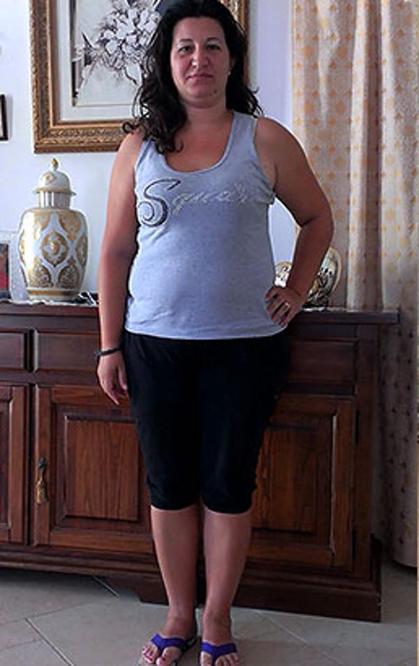 Maria Anna Parisi prima della dieta Bioimis