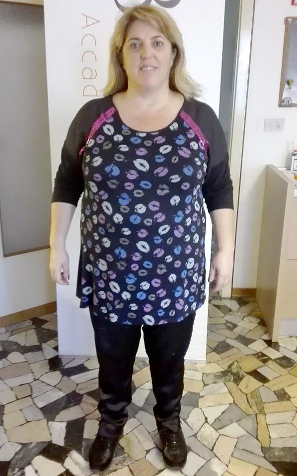 Annarita Rizzo prima della dieta Bioimis