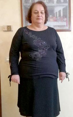 Maria Caruso prima della dieta Bioimis