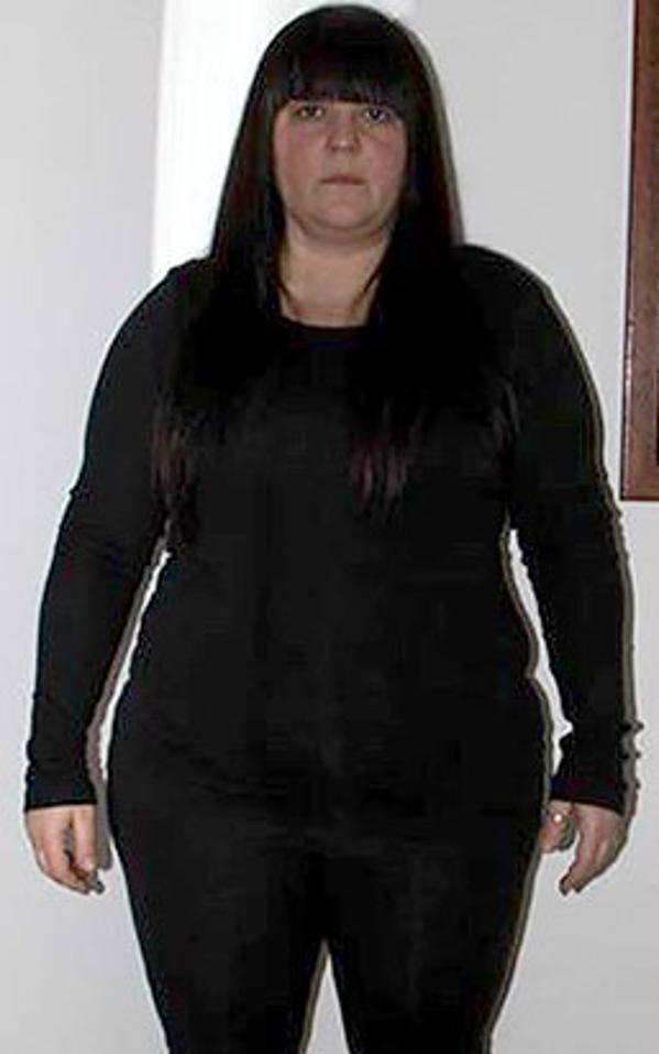 Paola Merendi prima della dieta Bioimis